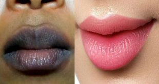 ঠোঁটের কালো দাগ দূর করার সহজ উপায় Lip Beauty tips Bangla